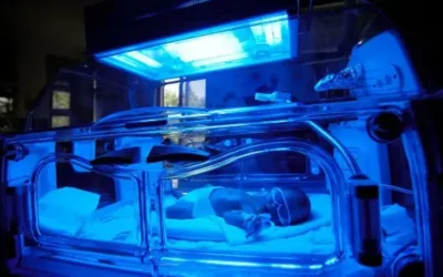 Jaundice in new born baby and how Dr Shrawan Kumar monitor and treat at NBCC